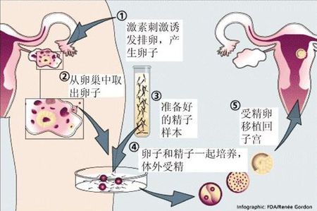 高龄二胎成功案例